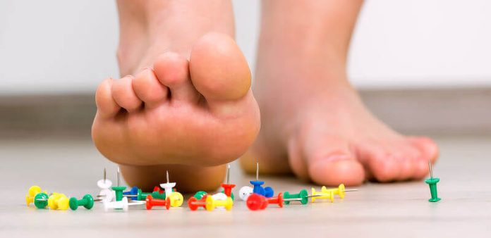 plantar fasciitis